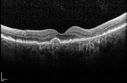 orbcell_pabr_101915_09.jpg