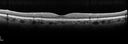 pamm-postcath-jeva-101717_23.jpg