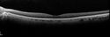 pamm-postcath-jeva-101717_24.jpg