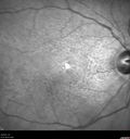 patternD_shsne_092817_03.jpg