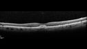patternD_shsne_092817_09.jpg