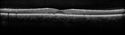 pattern_brcl_072616_11.jpg