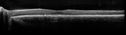 pattern_brcl_072616_12.jpg