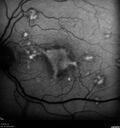 patterndys_husmi_021816_04.jpg