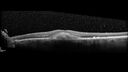 patterndys_husmi_021816_06.jpg