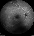 patterndys_husmi_021816_08.jpg