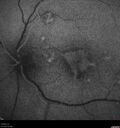 patterndys_husmi_021816_10.jpg