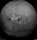 patterndys_husmi_021816_15.jpg