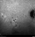 patterndys_husmi_021816_18.jpg