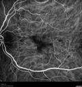 patterndys_husmi_021816_20.jpg