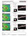 patterndys_husmi_021816_23.JPG