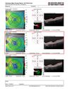 patterndys_husmi_021816_25.JPG