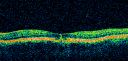 patterndyst_deub06.jpg