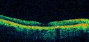 patterndystrophy_jowa05.jpg