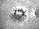 patterndystrophy_jowa10.jpg
