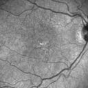 pcv_pulpoly_caga_030714_05.jpg