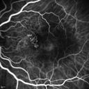 pcv_pulpoly_caga_030714_23.jpg
