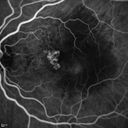 pcv_pulpoly_caga_030714_26.jpg