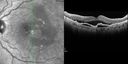 pcv_pulpoly_caga_040714_Peylea02.jpg