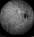 pcv_tecu_112717_30.jpg