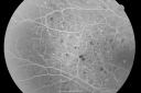 pdrmyodis_jeva_281129.png