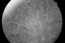 pdrmyodis_jeva_281529.png