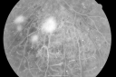 pdrmyodis_jeva_281729.png
