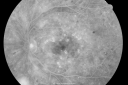 pdrmyodis_jeva_282029.png
