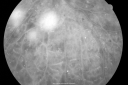 pdrmyodis_jeva_282429.png
