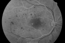 pdrmyodis_jeva_28829.png