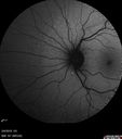 pic_CNVM-jewal_020619andlater14.jpg