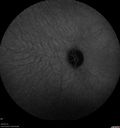 pic_CNVM-jewal_020619andlater32.jpg