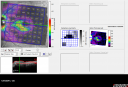 plaqtox_locl_12051109.png