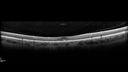 plaquenil_4yr_chfra_111819_13.jpg