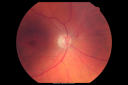 plaqueniltox_locl02.png