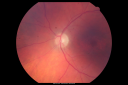 plaqueniltox_locl04.png