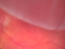 rdhangingmacula_chco03.png