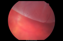 rdhangingmacula_chco06.png