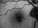 reticular_laio03.png