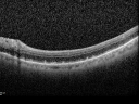 reticular_laio10.png
