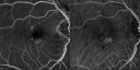 reticular_laio19.png