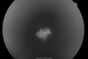 retinocytoma08.png