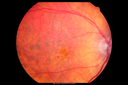 rmd_thjo_022312_01.png