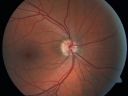 rpedysgenesis20110201_0002.jpg