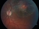 rpedysgenesis20110201_0003.jpg