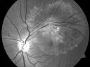 rpedysgenesis20110201_0009.jpg