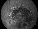 rpedysgenesis20110201_0013.jpg