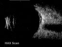 rpedysgenesis20110201_0025.jpg