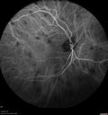 sarcoid_jamil_021216_19.jpg