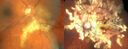 serpiginous-color.jpg